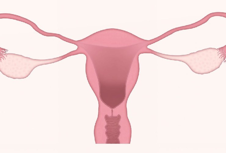 Patologie dell'apparato genitale femminile: polipi e fibromi